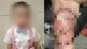 大陸,男童,家暴,燙傷,後母,母親,施暴
微博