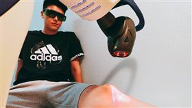 雷射除痛機器人(樂力適診所提供)