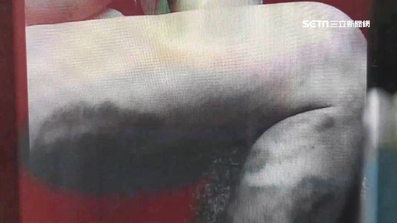 只因提不動行李！女慘忍水管抽打老母