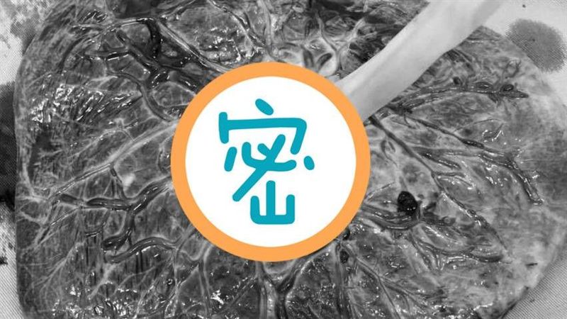 胎盤能吃？醫曬「胎盤本人」秒解惑