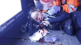 香港衝突女子眼睛受傷（圖／翻攝自Narziss Tang臉書）