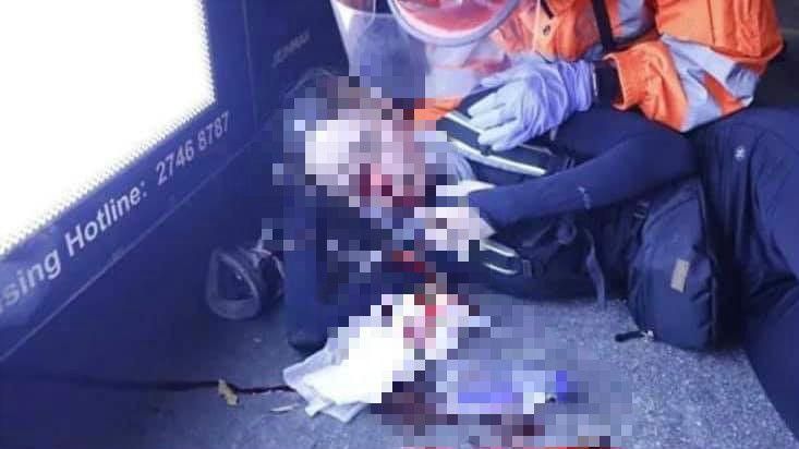 女子遭港警射布袋彈！眼球爆裂急送醫