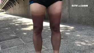 烈日消暑泛舟！男沒防曬腿慘變八分熟