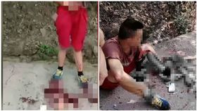 下班被撞「左手臂噴飛」！淡定男竟自己撿回來　送加護病房急救(圖/翻攝自梨視頻)