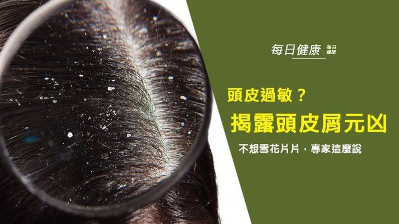 不想雪花片片？專家揭露頭皮屑元兇！