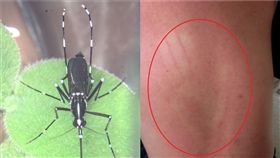 登革熱,掌印,皮疹,新北（圖／翻攝自疾管署）