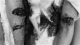 香港荃灣示威市民被砍(圖/反送中已核實資頻道)