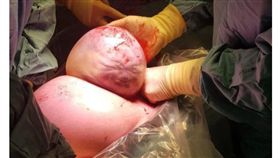 （圖／翻攝自aFamily）英國,生產,剖腹,羊膜囊,外星人