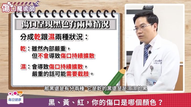 別再用OK繃了　小心傷口會惡化！