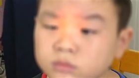 鬥雞眼,手機,大陸,安徽,合肥,近視,斜視,檢查,控制,作業, 圖／翻攝自微博