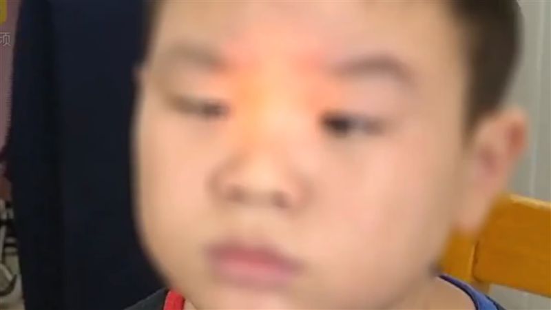 日玩10小時手機　9歲男童變鬥雞眼