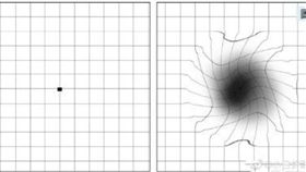 黃斑部裂孔,黑洞,阿姆斯勒方格表（圖／翻攝自微博）