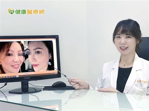 線性提拉打造高挺美鼻 五官更立體!