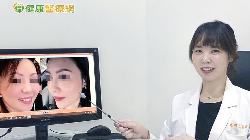 線性提拉打造高挺美鼻　五官更立體！