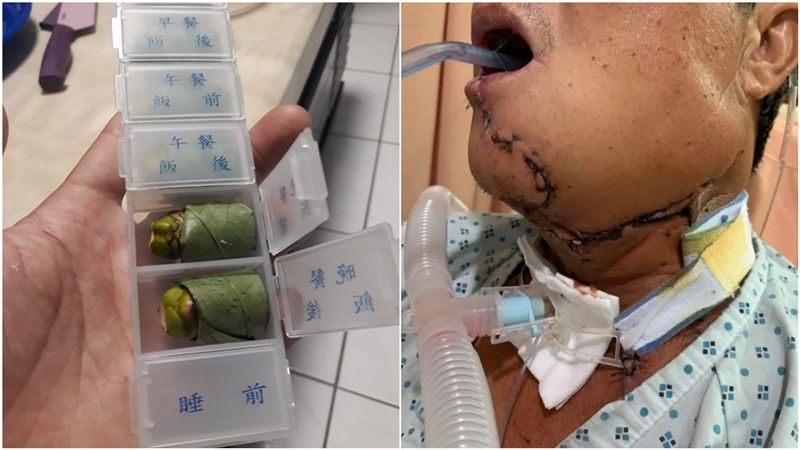 老婆神招逼戒檳榔…他見藥盒狂嘆氣