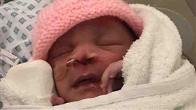 英國,剖腹產,醫療糾紛,手術,劃傷,整形,修復,裂痕,胎位不正,　圖／翻攝自臉書