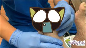 Healthy Feet Podiatry,腳指甲,真菌,變形,覆蓋,治療,截肢,感染,美國,　圖／翻攝自YouTube