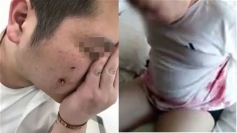玻璃杯爆裂刺傷臉？男苦肉計詐騙被抓