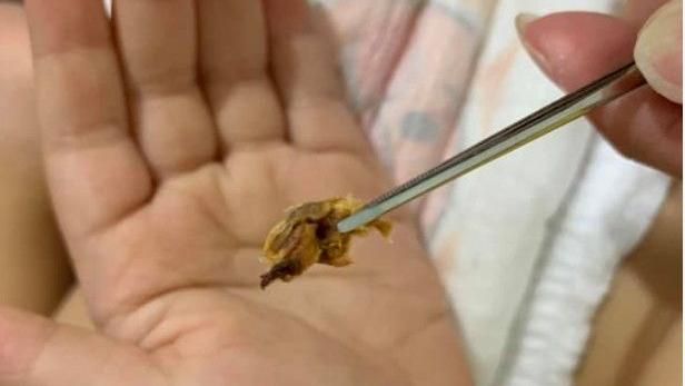 媽夾出巨型耳屎！4歲兒一句話網笑瘋
