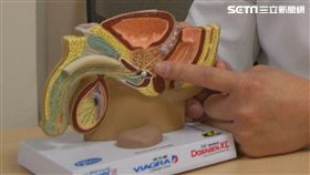 安南醫院,泌尿科,林育緯,尿尿,膀胱,腎臟,攝護腺