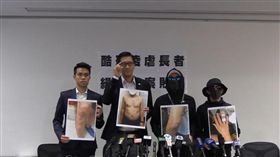 港警,施虐,私刑,醫院,香港／翻攝林卓廷臉書