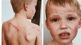 可愛袋鼠發狂猛打！5歲男童險被「活活揍死」　傷痕超驚悚（圖／翻攝自bevydyer IG）