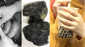 珍珠奶茶、手搖飲、飲料、越南,珍珠奶茶,腸梗阻(圖/翻攝自vietnamnet、資料照)