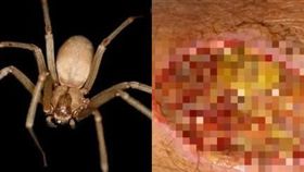 美國,蜘蛛,耳朵,棕色遁蛛。(圖/翻攝自independent)