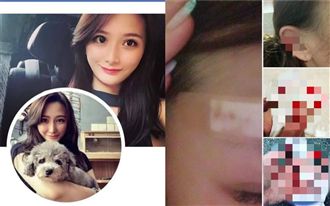 挺港警卻遭4警暴打…正妹破相怒了！