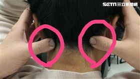 風池穴。（圖／記者楊晴雯攝）