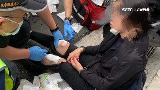 逆向害摔又肇逃！女骨折縫11針破相