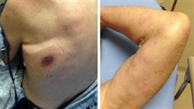 戲水後驚現「詭異紅斑」　2天離奇亡（圖／翻攝自Cheryl Bennett Wiygul臉書）