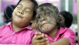 消化不良藥被生髮藥污染　西班牙16嬰孩服用後慘變「毛小孩」（圖／太陽報）