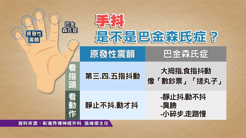 手抖不停是巴金森氏症?小心它惹的禍