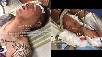 吳小哲被斷手腳恐截肢　警逮3惡煞