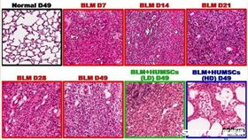 肺部纖維化的大白鼠在植入人類臍帶間質幹細胞後，肺泡面積的變化。（圖／陽明大學提供）