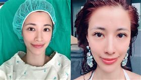 李蒨蓉手術苦中作樂：還好老公沒有把我推下去（圖／翻攝自李蒨蓉臉書）