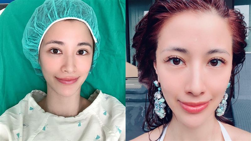 李蒨蓉坐輪椅！感謝尪「沒推我下山」