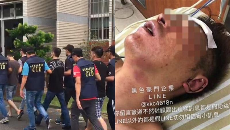 直播主遭斷手腳　導火線原因曝光