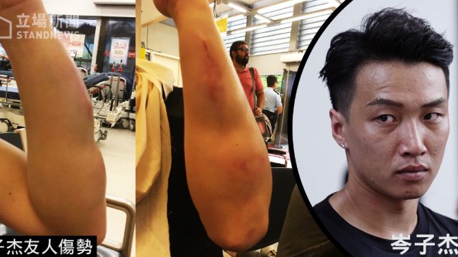 香港民陣召集人遇襲　蒙面人持棍狂毆