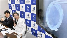 誘導性多功能幹細胞,眼角膜細胞移植,視力改善,日本,iPS細胞