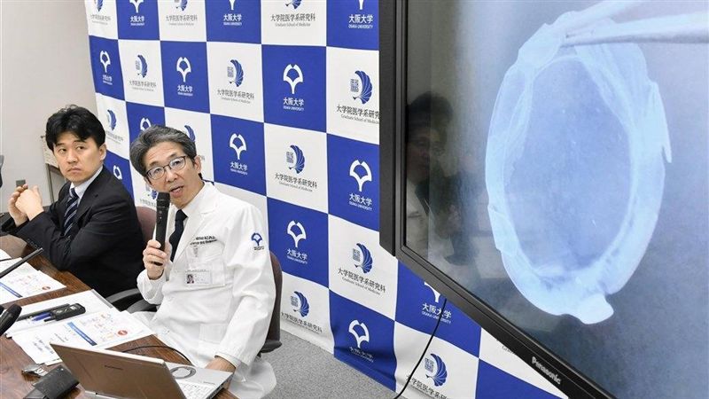 日細胞角膜移植　近全盲者視力可恢復