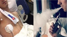 18歲男大生吸1年電子菸！「肺部塌陷」住院險死(圖/翻攝自IG chanceammirata、flickr