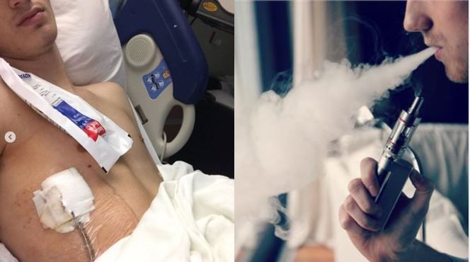 18歲男愛電子菸　「肺部破洞」險死