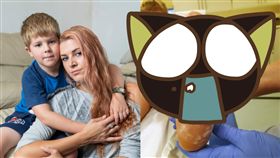 燙傷,水泡,沙灘,埋火,掩埋,烤肉架,受傷,英國,海邊,烤肉,　圖／翻攝自推特