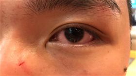 香港眾志副主席鄭家朗遇襲　3男揮拳毆打
▲（圖／翻攝自香港眾志 Demosistō臉書）