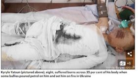 8歲男童遭「未成年惡霸」潑汽油點火！母淚：他們是惡魔（圖／翻攝自《每日郵報》）