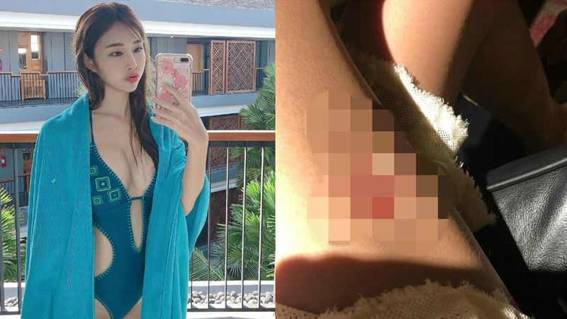 天菜妹解放雪乳　竟遭狗狠咬傷口曝光