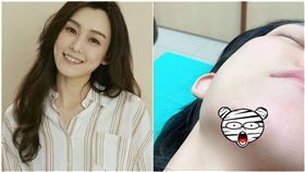  藝人「范范」范瑋琪今（5）日凌晨又傳出跌倒的消息，她在IG上貼出血淋淋的傷口照，可以看到她的下巴有一塊肉被掀起，似乎傷的不輕，范范也表示傷口已經縫了15針，目前無大礙，還拍照跟粉絲報平安，敬業的她更說今日將如期出席預定的時尚活動。（圖／翻攝自范瑋琪IG）