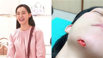 破相！范范還原意外現場：地毯全是血